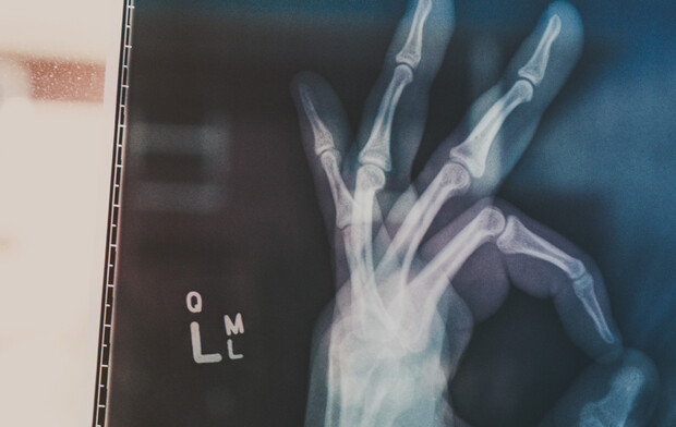 Reha-Beratung: Zurück in den Job